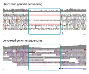 IGV view of GRIA2 deletion