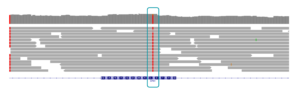IGV view of homozygous CPS1 variant